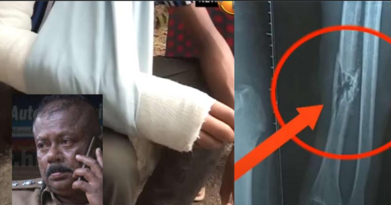 Terror at Rambukkana: A 15-year-old schoolboy shot in the police shooting