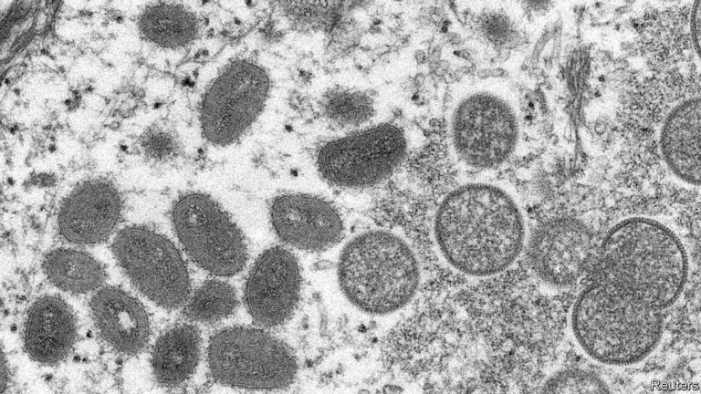 Monkeypox is popping up in more countries. How worrying is this?