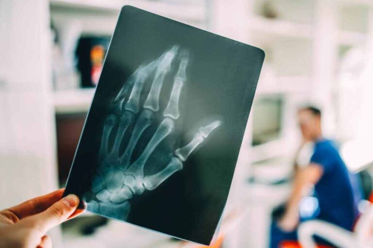 X-Ray machines at Emergency Unit of Colombo National Hospital malfunctioned!