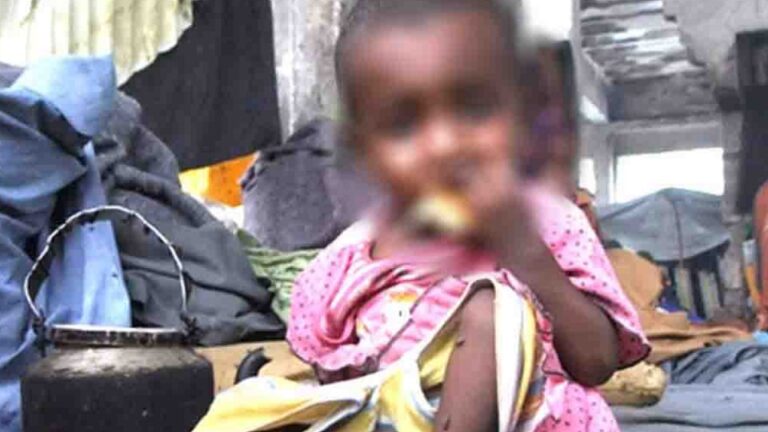 PSC appointed to probe child malnutrition in SL