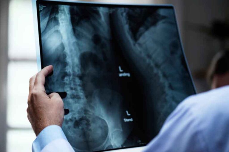 Staffing crisis halts X-Ray services in six hospitals