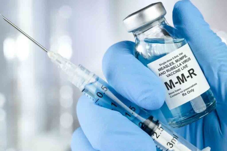 SL reports measles cases surge in 09 districts