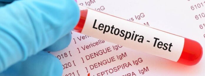 Health Ministry takes action as leptospirosis outbreak claims lives in Northern Province