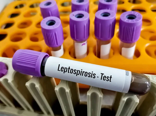 Mysterious illness causing fatalities in North identified as Leptospirosis