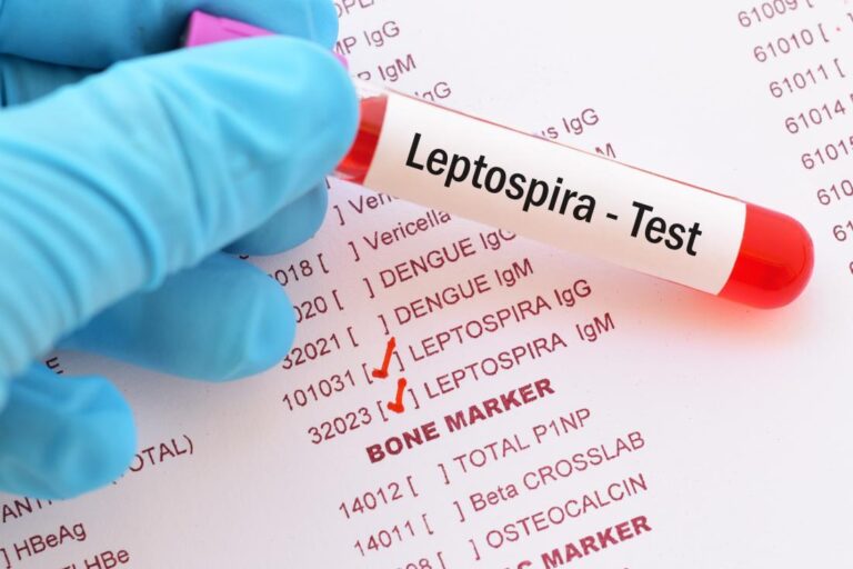 Vavuniya reports 41 cases of leptospirosis in 2024, urges prevention measures for farmers